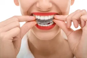 woman placing invisalign