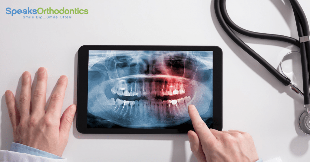 Orthodontist reviewing a digital dental X-ray of teeth and jaw on a tablet
