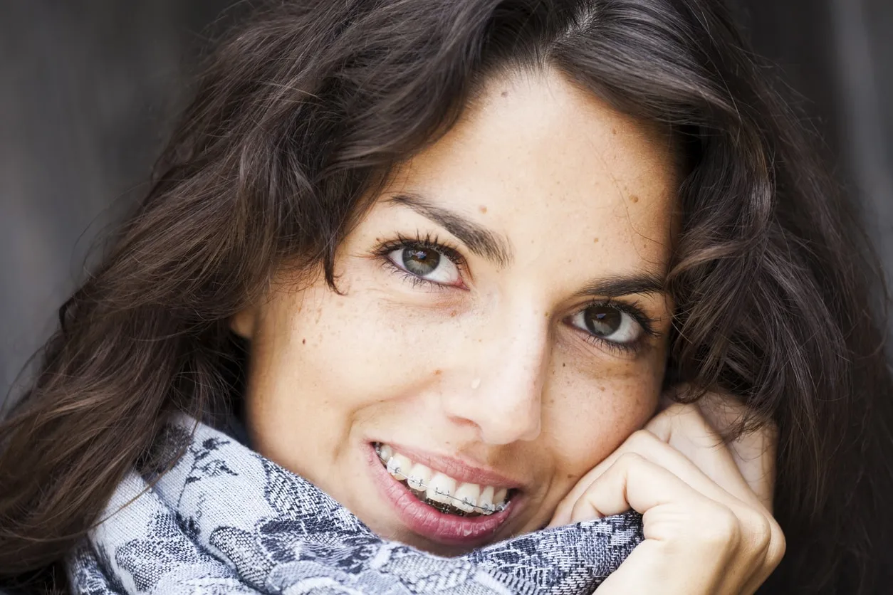 Close up of brunette with braces