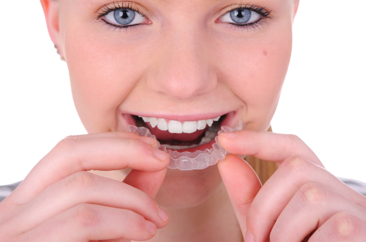 Closeup of woman putting in Invisalign retainer