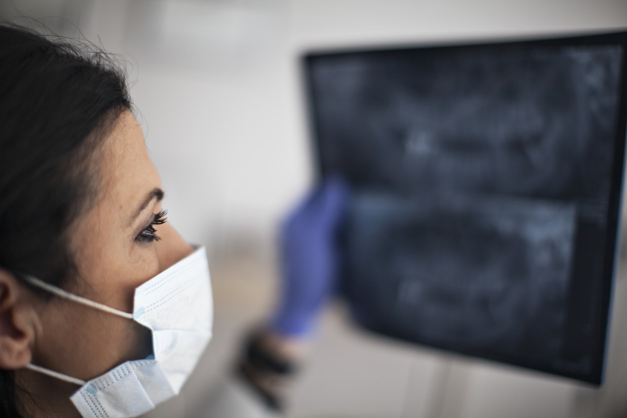 Female dentist holding up Xray