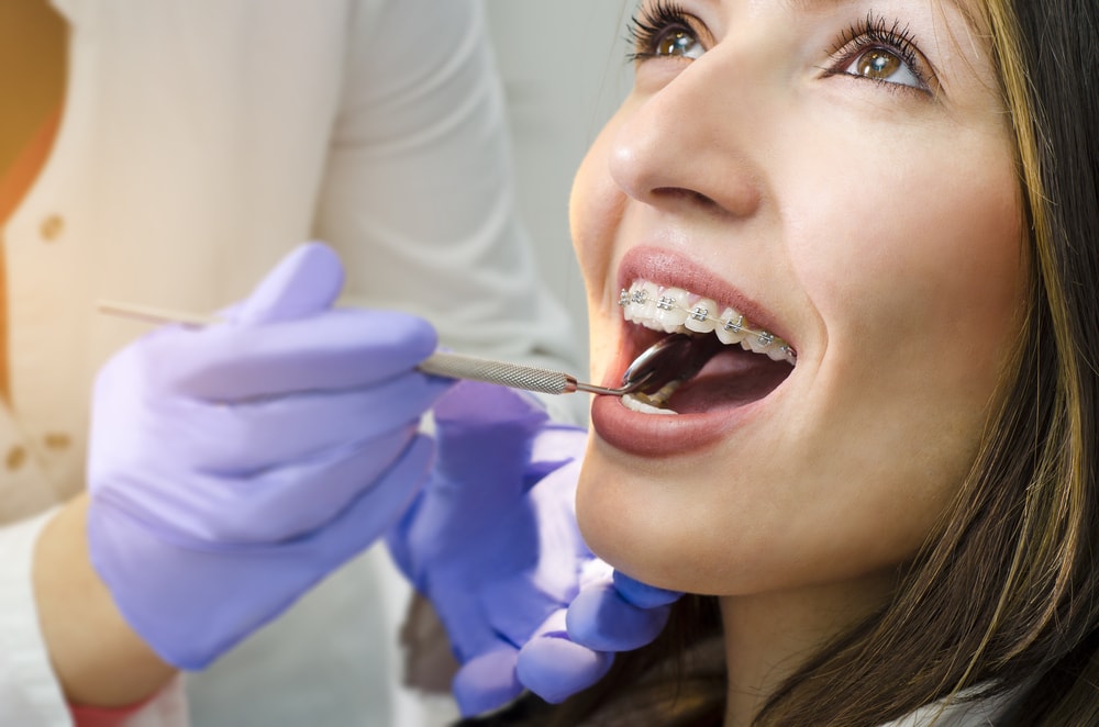 You woman with braces smiling during exam