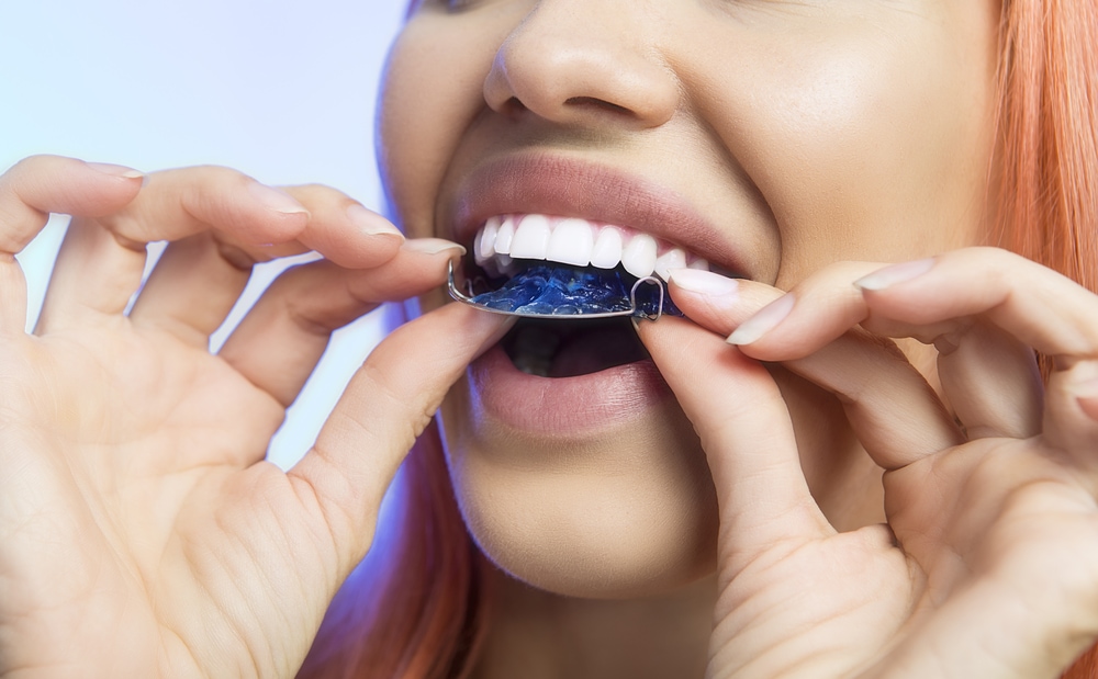 Woman putting in retainer